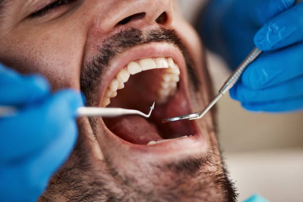 Dental X-Rays and Imaging in Conesus Lake, NY