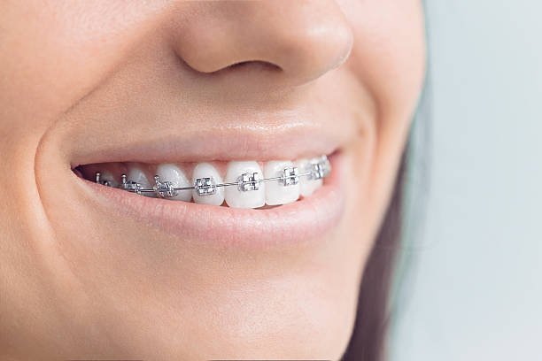 Best Veneers and Lumineers  in Conesus Lake, NY